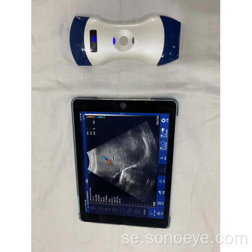 Double Head Probe Wireless Mini Color Doppler Ultraljud